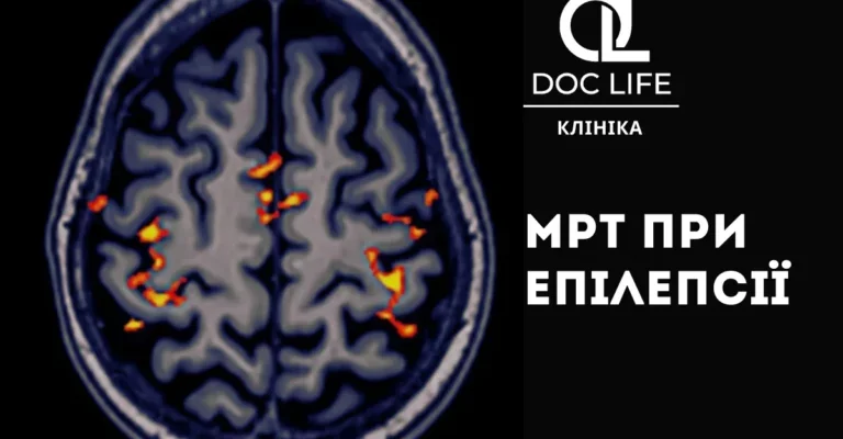 Загальномозкові зміни іритативного характеру: що це означає?