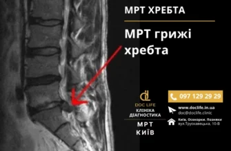 Чи дають інвалідність при грижі хребта: умови та критерії оцінки