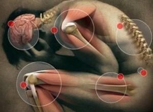 Хвороба м’язів: причини, симптоми та ефективні методи лікування