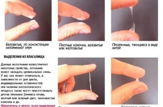 Які виділення під час вагітності: норма, відхилення та догляд Які виділення під час вагітності: норма, відхилення та догляд