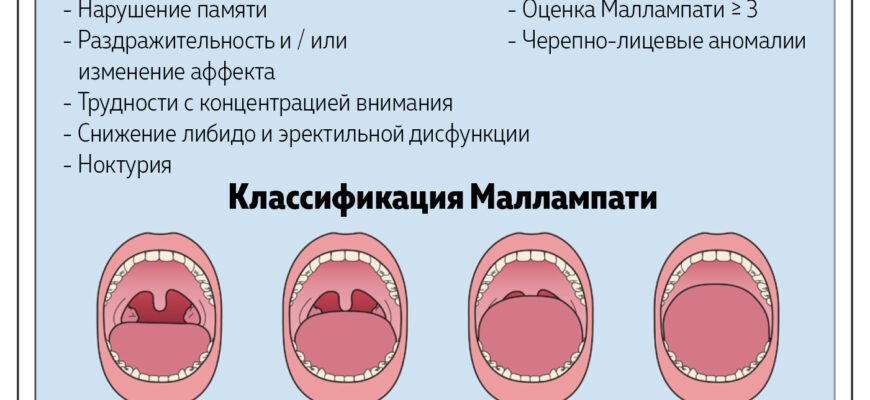 Що таке апное: причини, симптоми та методи діагностики розладу
