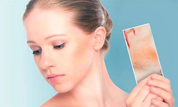 Зміни на обличчі під час вагітності: причини та способи догляду Зміни на обличчі під час вагітності: причини та способи догляду