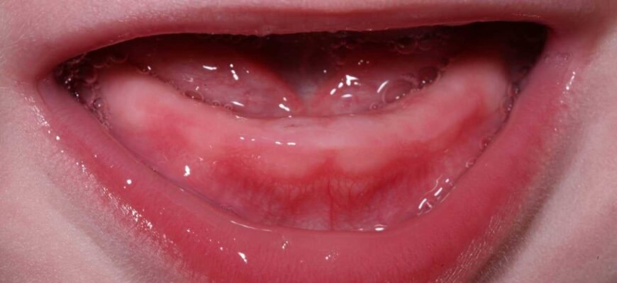 Ясна при прорізуванні зубів: поради з догляду та рекомендації