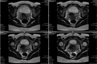 Інволютивні зміни органів малого тазу: причини та наслідки для здоров’я