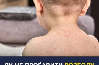 Висока температура у дитини без симптомів: що робити батькам?