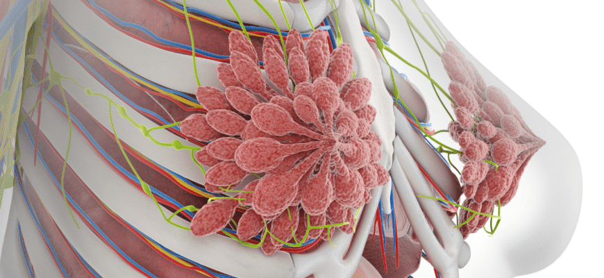 Фіброзно кістозні зміни молочних залоз: причини та лікування