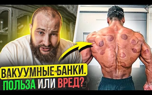 Банки на спину: користь і шкода для здоров’я – що кажуть експерти?