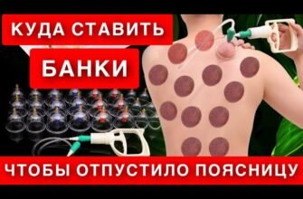 Як правильно ставити банки на спину: покрокова інструкція і поради