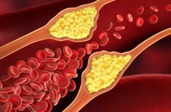 ЕТ на дисках: Що це таке і як впливає на ваш автомобіль?