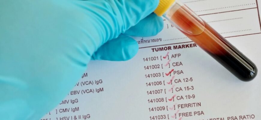 Гравіювання: Поглиблений огляд техніки та її застосування Гравіювання: Поглиблений огляд техніки та її застосування