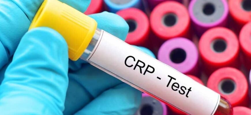 Чому варто купувати чи орендувати житло у Варшаві через рієлтора? Чому варто купувати чи орендувати житло у Варшаві через рієлтора?