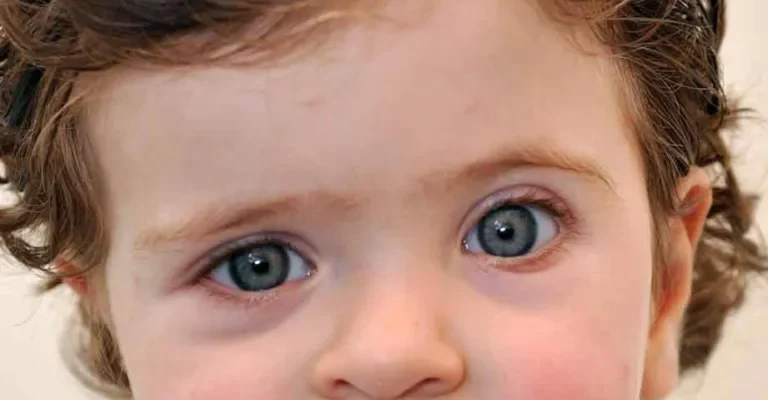 Плоска голова у дитини: що робити для виправлення форми?