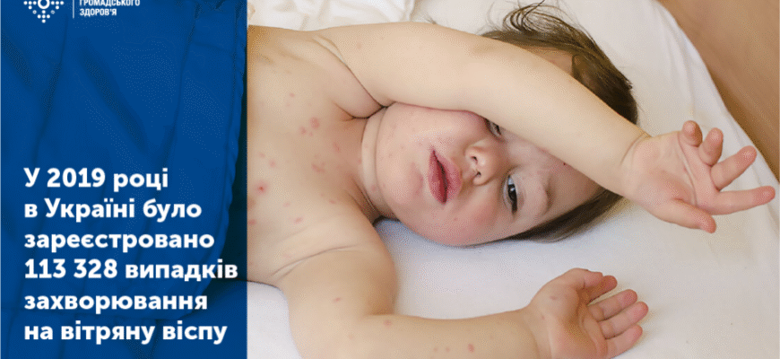 Скільки днів триває температура при вірусній інфекції: основні факти