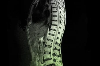 Дегенеративно дистрофічні зміни грудного відділу хребта: симптоми і лікування