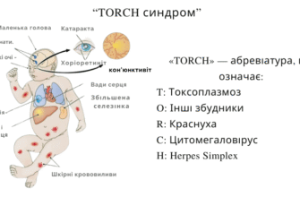 Інфекції: як захиститися та запобігти поширенню захворювань