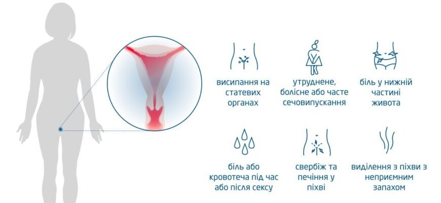 Що таке ЗПСШ: основи, симптоми та профілактика захворювань