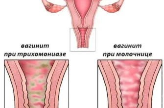 Статеві інфекції у жінок: симптоми, діагностика та профілактика