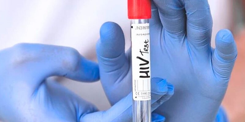 Гостра стадія ВІЛ-інфекції: найчастіші прояви та симптоми