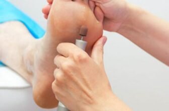 Як видалити стрижневий мозоль у дитини: ефективні методи та поради