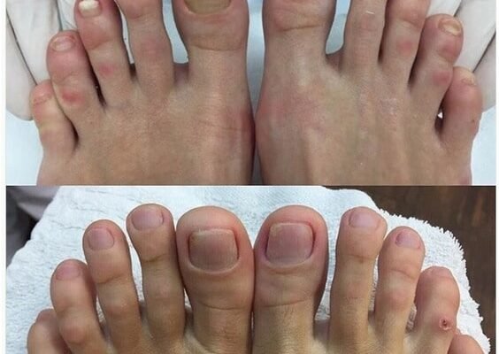 Подолог, що лікує: професійний догляд за вашими стопами