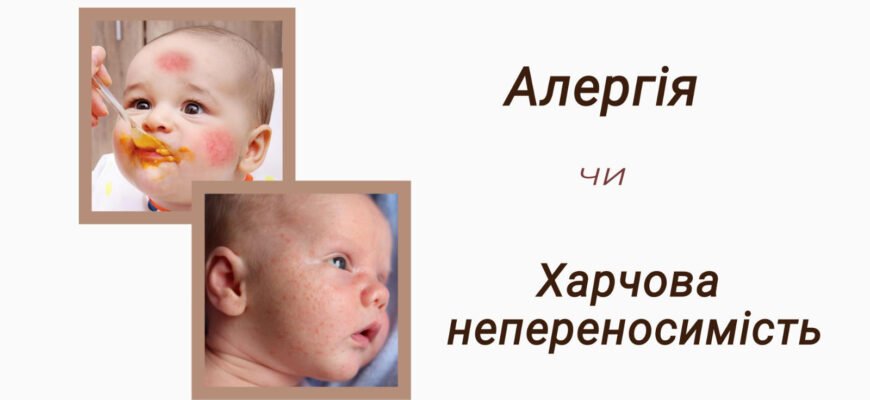 Харчова алергія: як розпізнати алергічну висипку у дитини? Харчова алергія: як розпізнати алергічну висипку у дитини?
