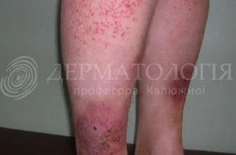 Які бувають захворювання судин: основні типи та їх ознаки