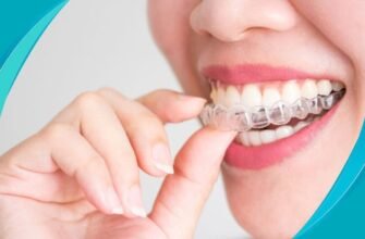 Ортодонтія: шлях до ідеальної посмішки