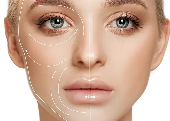 Скільки тримається філер у різних зонах обличчя: що реально впливає на ефект