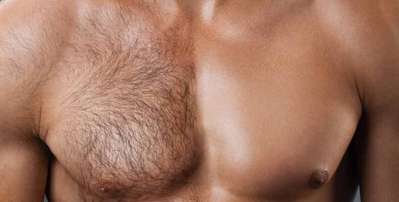 Лазерна епіляція чоловіча: коли потрібна не «естетика», а практичний комфорт