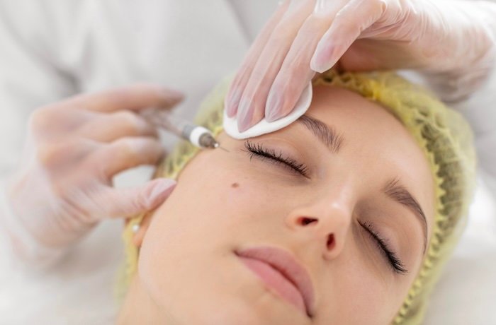 Біоревіталізація