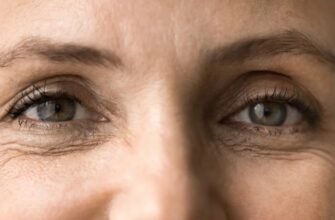 От чего зависит стоимость блефаропластики и почему опускаются нижние веки? От чего зависит стоимость блефаропластики и почему опускаются нижние веки?