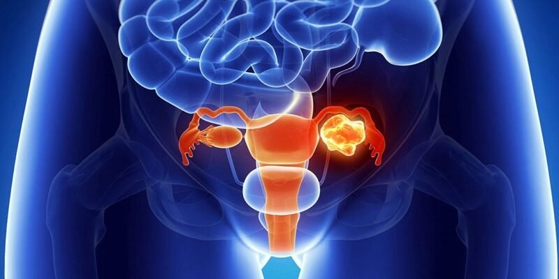 МРТ органів малого таза: коли призначають жінкам і чоловікам