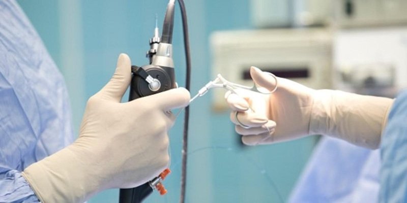 Колоноскопія: коли її призначають і як правильно підготуватися до обстеження Колоноскопія: коли її призначають і як правильно підготуватися до обстеження